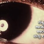 ನ್ಯೂನತಾ ಕಾಯಿಲೆಗಳು, ಕಾರಣಗಳು ಮತ್ತು ಲಕ್ಷಣಗಳು