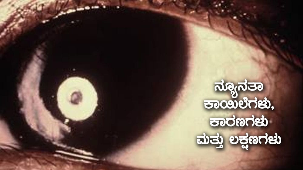 ನ್ಯೂನತಾ ಕಾಯಿಲೆಗಳು, ಕಾರಣಗಳು ಮತ್ತು ಲಕ್ಷಣಗಳು