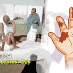 World Leprosy Day